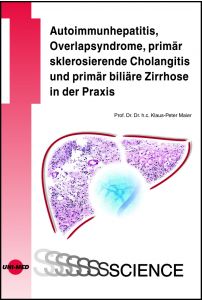 Autoimmunhepatitis, Overlapsyndrome, primär sklerosierende Cholangitis und primär biliäre Zirrhose in der Praxis