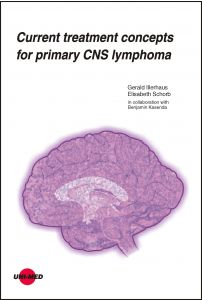 Current treatment concepts for primary CNS lymphoma