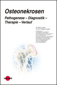 Osteonekrosen. Pathogenese – Diagnostik – Therapie – Verlauf