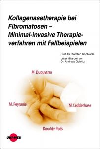 Kollagenasetherapie bei Fibromatosen – Minimal-invasive Therapieverfahren mit Fallbeispielen