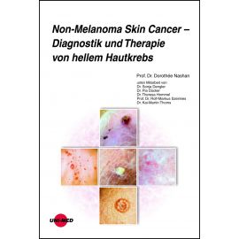 Non-Melanoma Skin Cancer - Diagnostik und Therapie von hellem Hautkrebs