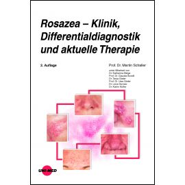 Rosazea – Klinik, Differentialdiagnostik und aktuelle Therapie